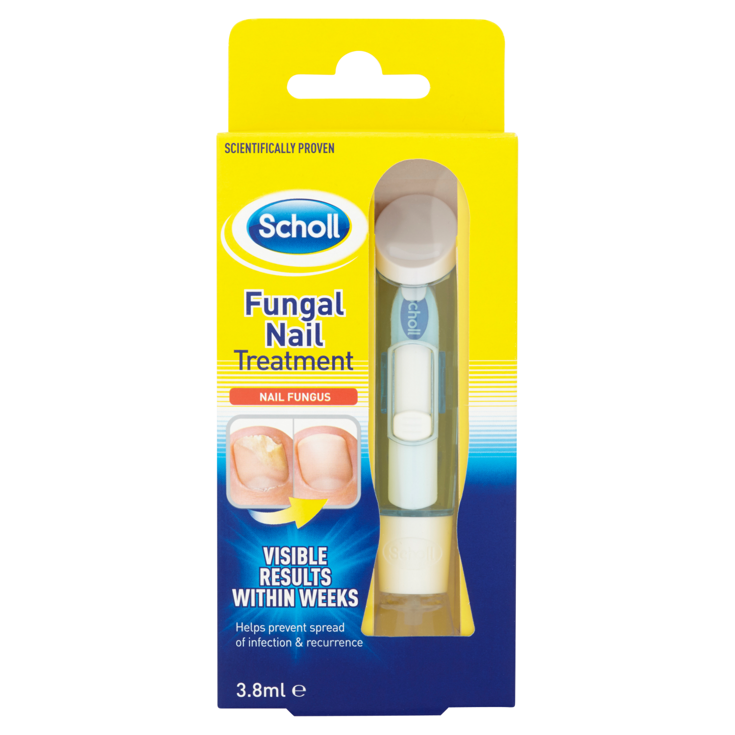 Fungal Nail Infection Treatment | Scholl UK